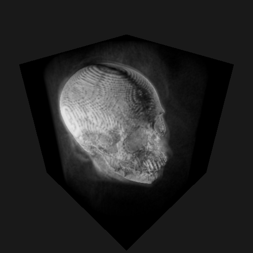 A 3D volumetric model of a human skull